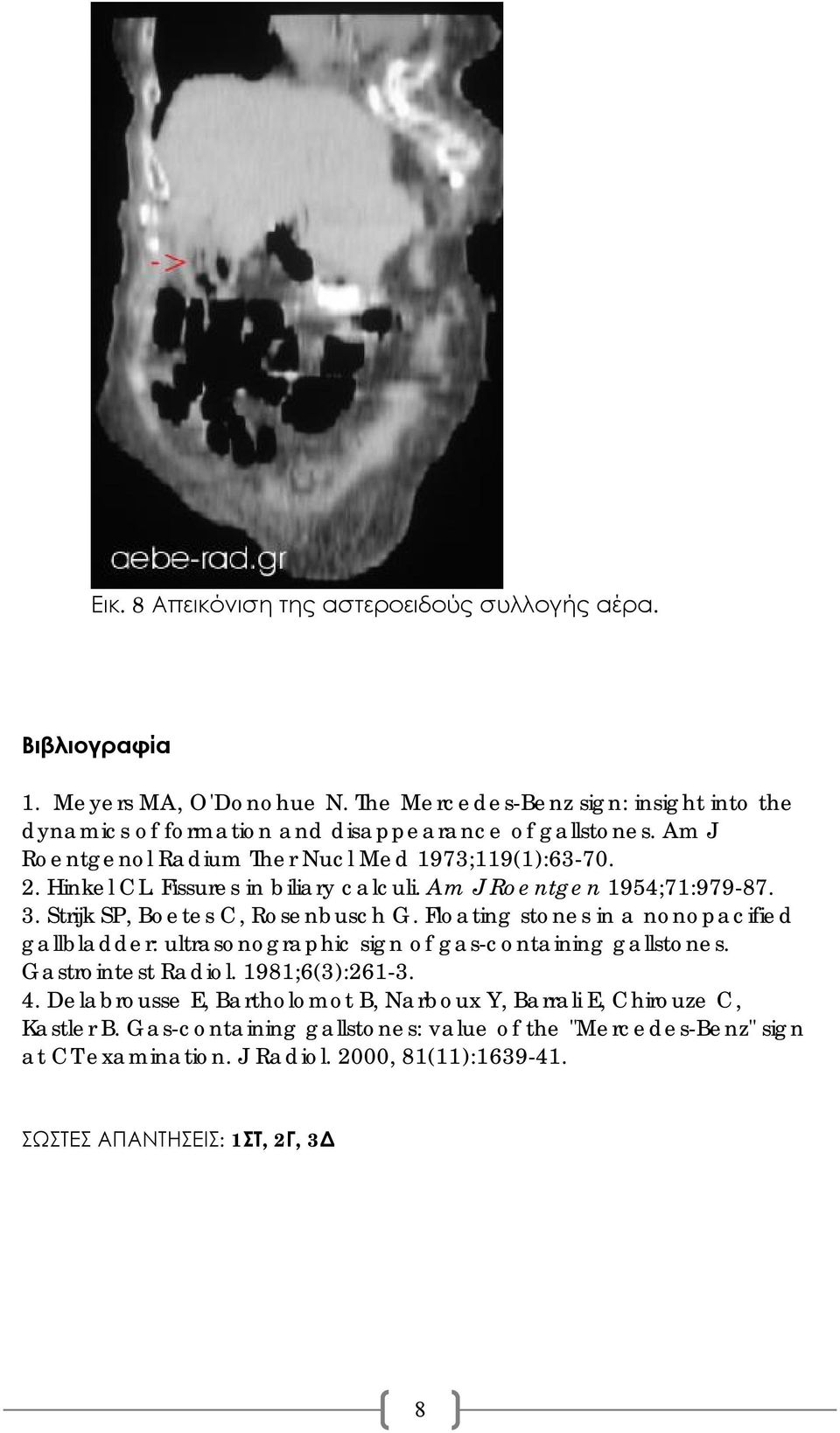 Fissures in biliary calculi. Am J Roentgen 1954;71:979-87. 3. Strijk SP, Boetes C, Rosenbusch G.