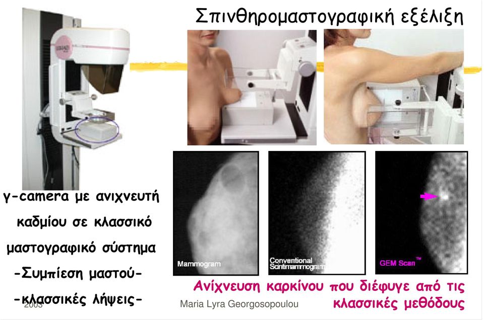 σύστημα -Συμπίεση μαστού- -κλασσικές λήψεις-