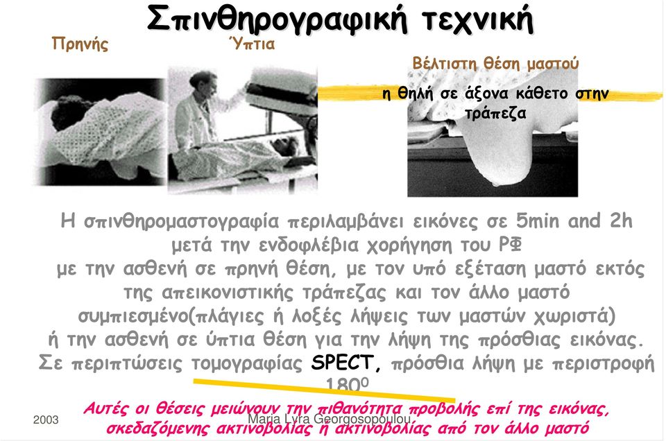 συμπιεσμένο(πλάγιεςήλοξέςλήψειςτωνμαστώνχωριστά) ήτηνασθενήσεύπτιαθέσηγιατηνλήψητηςπρόσθιαςεικόνας.