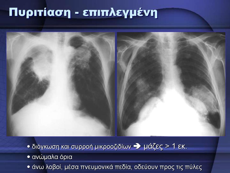 εθ. αλψκαια φξηα άλσ ινβνί, κέζα