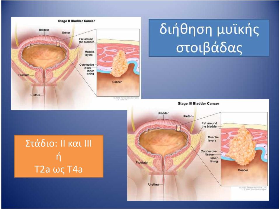 στοιβάδας