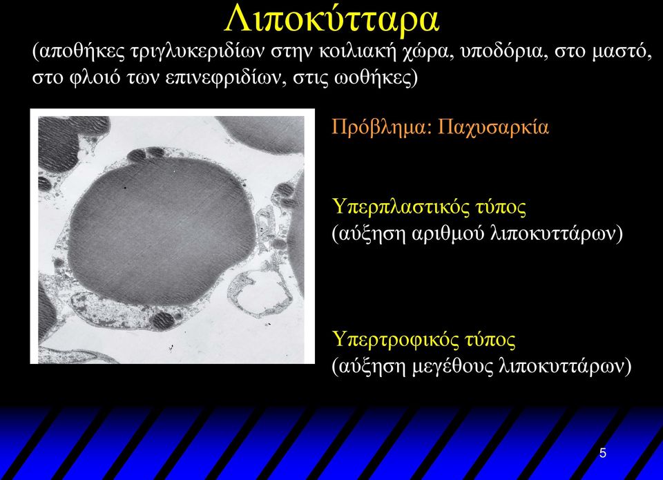 ωοθήκες) Πρόβλημα: Παχυσαρκία Υπερπλαστικός τύπος (αύξηση