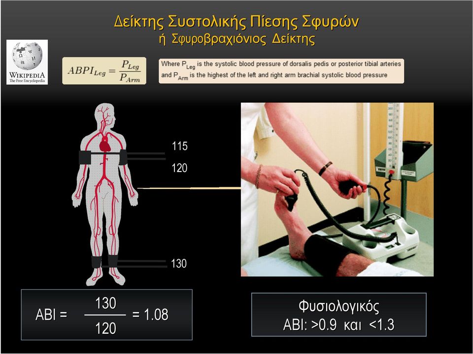 ABI = = 1.08 120 Φυσιολογικός ΑBI: >0.