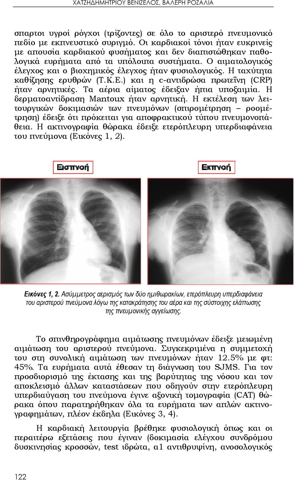 Ο αιματολογικός έλεγχος και ο βιοχημικός έλεγχος ήταν φυσιολογικός. Η ταχύτητα καθίζησης ερυθρών (Τ.Κ.Ε.) και η c-αντιδρώσα πρωτεΐνη (CRP) ήταν αρνητικές. Τα αέρια αίματος έδειξαν ήπια υποξαιμία.