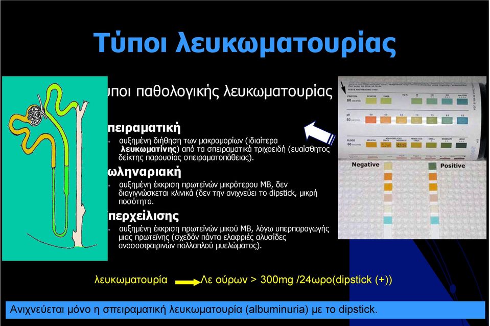 Σωληναριακή αυξηµένη έκκριση πρωτεϊνών µικρότερου ΜΒ, δεν διαγιγνώσκεται κλινικά (δεν την ανιχνεύει το dipstick, µικρή ποσότητα.