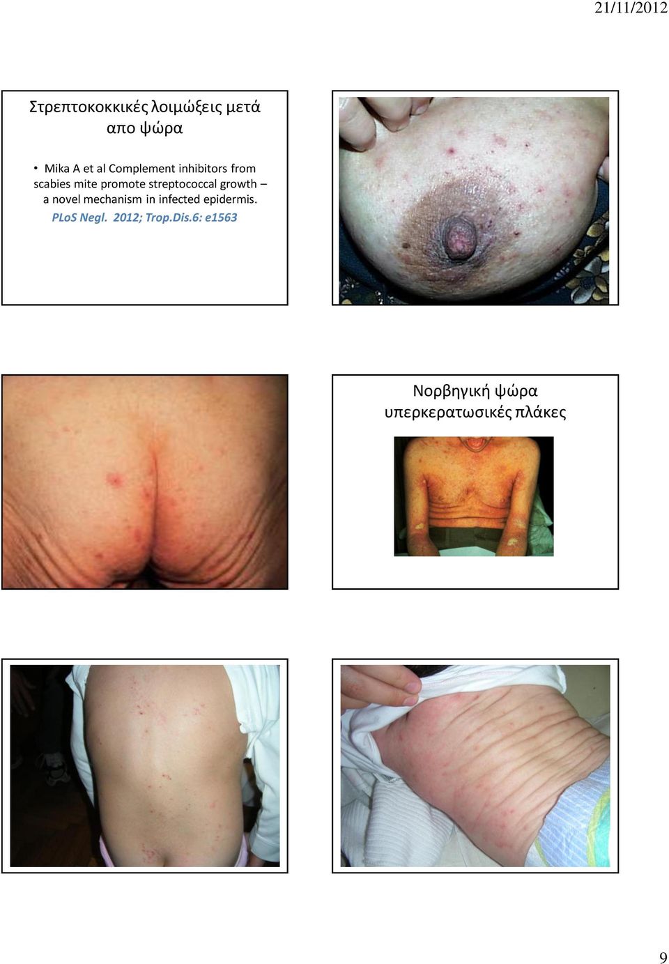 streptococcal growth a novel mechanism in infected