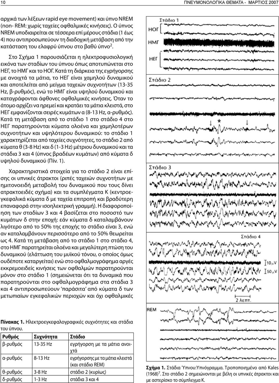Στο Σχήμα 1 παρουσιάζεται η ηλεκτροφυσιολογική εικόνα των σταδίων του ύπνου όπως αποτυπώνεται στο ΗΕΓ, το ΗΜΓ και το ΗΟΓ.