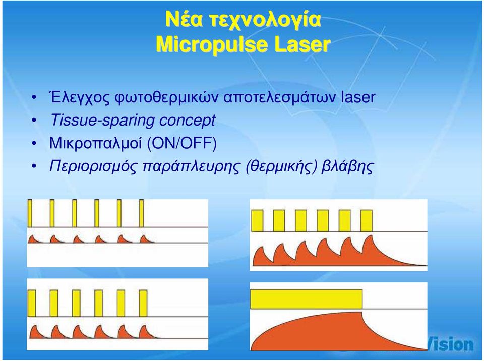 Tissue-sparing concept Mικροπαλµοί