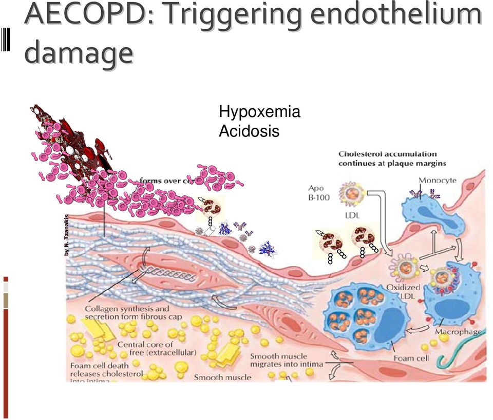 endothelium