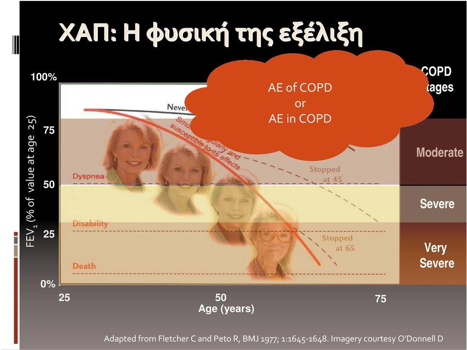 COPD Stages Moderate Severe Very Severe Adapted from Fletcher