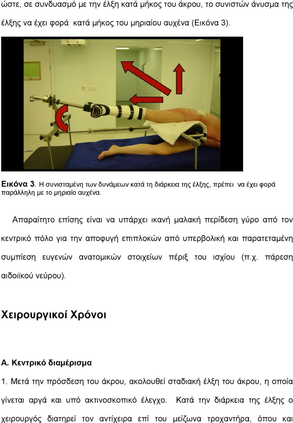 Απαραίτητο επίσης είναι να υπάρχει ικανή μαλακή περίδεση γύρο από τον κεντρικό πόλο για την αποφυγή επιπλοκών από υπερβολική και παρατεταμένη συμπίεση ευγενών ανατομικών στοιχείων πέριξ