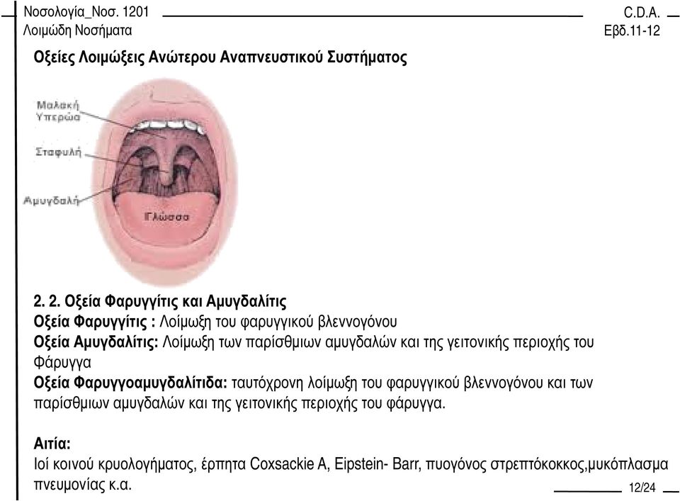 παρίσθµιων αµυγδαλών και της γειτονικής περιοχής του Φάρυγγα Οξεία Φαρυγγοαµυγδαλίτιδα: ταυτόχρονη λοίµωξη του φαρυγγικού