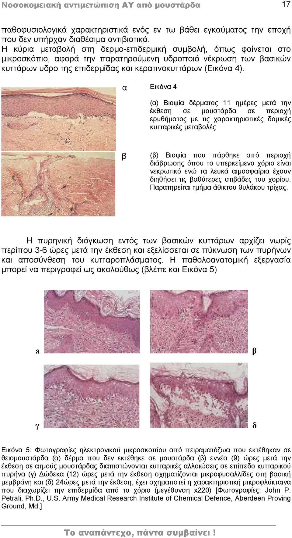 α Εικόνα 4 (α) Βιοψία δέρματος 11 ημέρες μετά την έκθεση σε μουστάρδα σε περιοχή ερυθήματος με τις χαρακτηριστικές δομικές κυτταρικές μεταβολές β (β) Βιοψία που πάρθηκε από περιοχή διάβρωσης όπου το