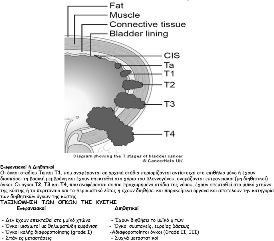 Οι όγκοι Τ2, Τ3 και Τ4, που αναφέρονται σε πιο προχωρημένα στάδια της νόσου, έχουν επεκταθεί στο μυϊκό χιτώνα της κύστης ή το περιτόναιο και το περικυστικό λίπος ή έχουν διηθήσει και παρακείμενα