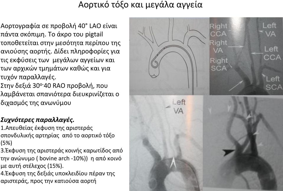 Στηνδεξιά30 οl 40RAOπροβολή,που λαμβάνεταισπανιότεραδιευκρινίζεταιο διχασμόςτηςανωνύμου Συχνότερεςπαραλλαγές. 1.