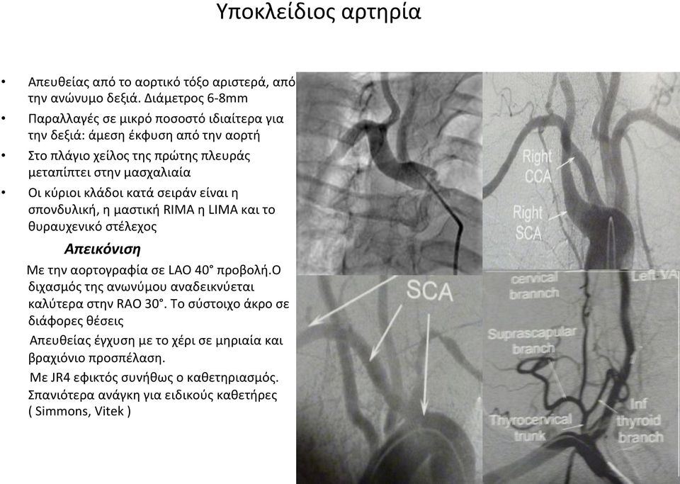 Οικύριοικλάδοικατάσειράνείναιη σπονδυλική,ημαστικήrimaηlimaκαιτο θυραυχενικόστέλεχος Απεικόνιση ΜετηναορτογραφίασεLAO40 προβολή.