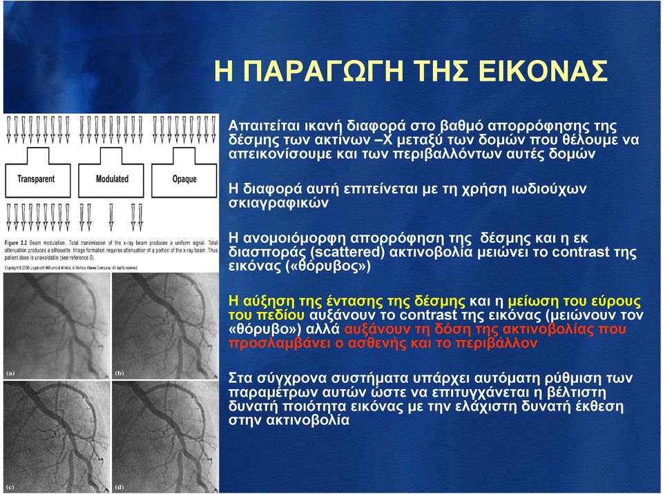 της έντασης της δέσμης και η μείωση του εύρους του πεδίου αυξάνουν το contrast της εικόνας (μειώνουν τον «θόρυβο») αλλά αυξάνουν τη δόση της ακτινοβολίας που προσλαμβάνει ο ασθενής και