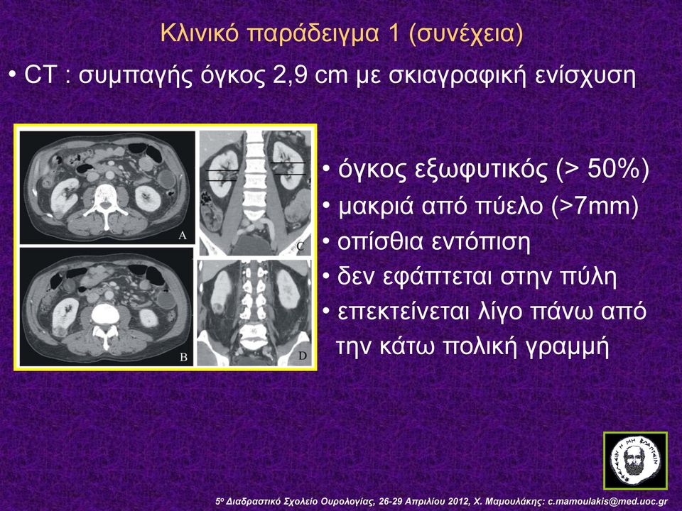 μακριά από πύελο (>7mm) οπίσθια εντόπιση δεν εφάπτεται