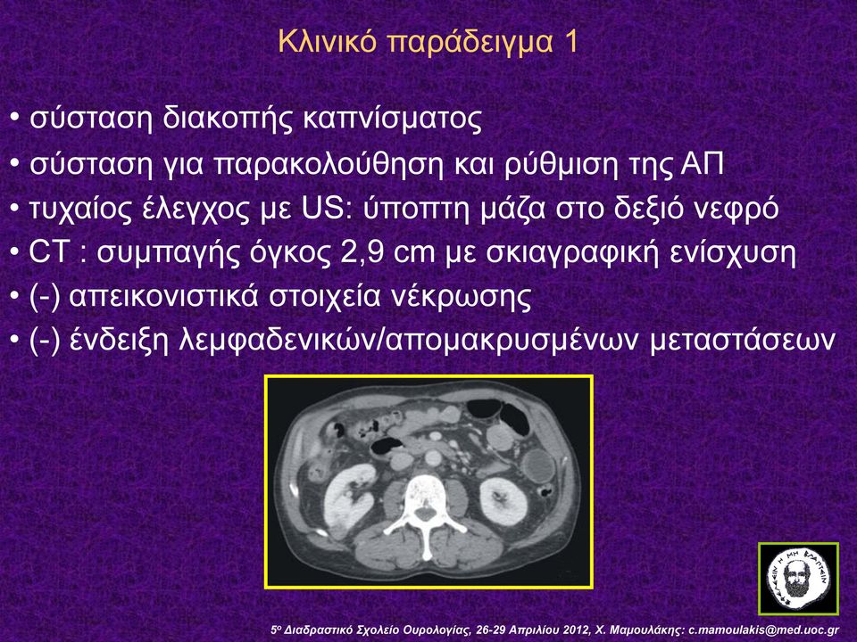 στο δεξιό νεφρό CT : συμπαγής όγκος 2,9 cm με σκιαγραφική ενίσχυση (-)