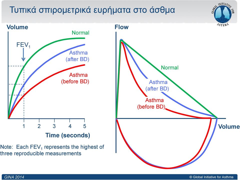 Asthma (before BD) 1 2 3 4 5 Time (seconds) Volume Note: Each FEV