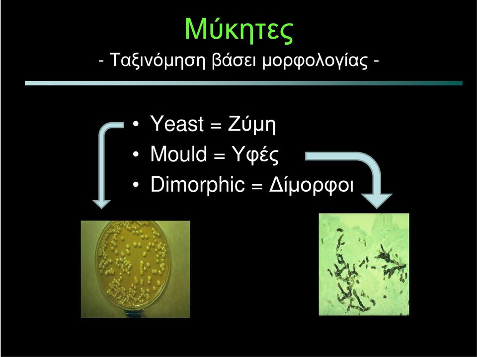 Yeast = Ζύμη Mould=