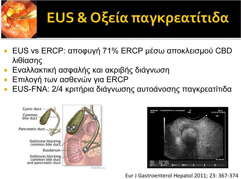 των ασθενών για ERCP EUS-FNA: 2/4 κριτήρια διάγνωσης