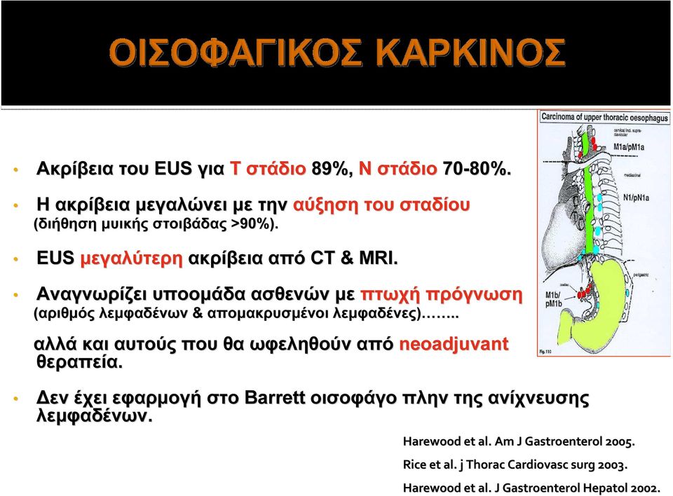 Αναγνωρίζει υποομάδα ασθενών με πτωχή πρόγνωση (αριθμός λεμφαδένων & απομακρυσμένοι λεμφαδένες).