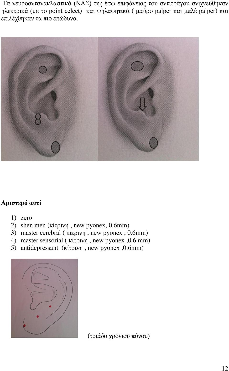 Απιζηεπό αςηί 2) shen men (θίηξηλε, new pyonex, 0.6mm) 3) master cerebral ( θίηξηλε, new pyonex, 0.