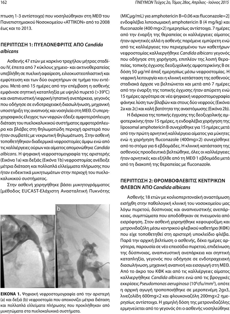 ειλεοκυστεοπλαστική και εμφύτευση και των δύο ουρητήρων σε τμήμα του εντέρου.