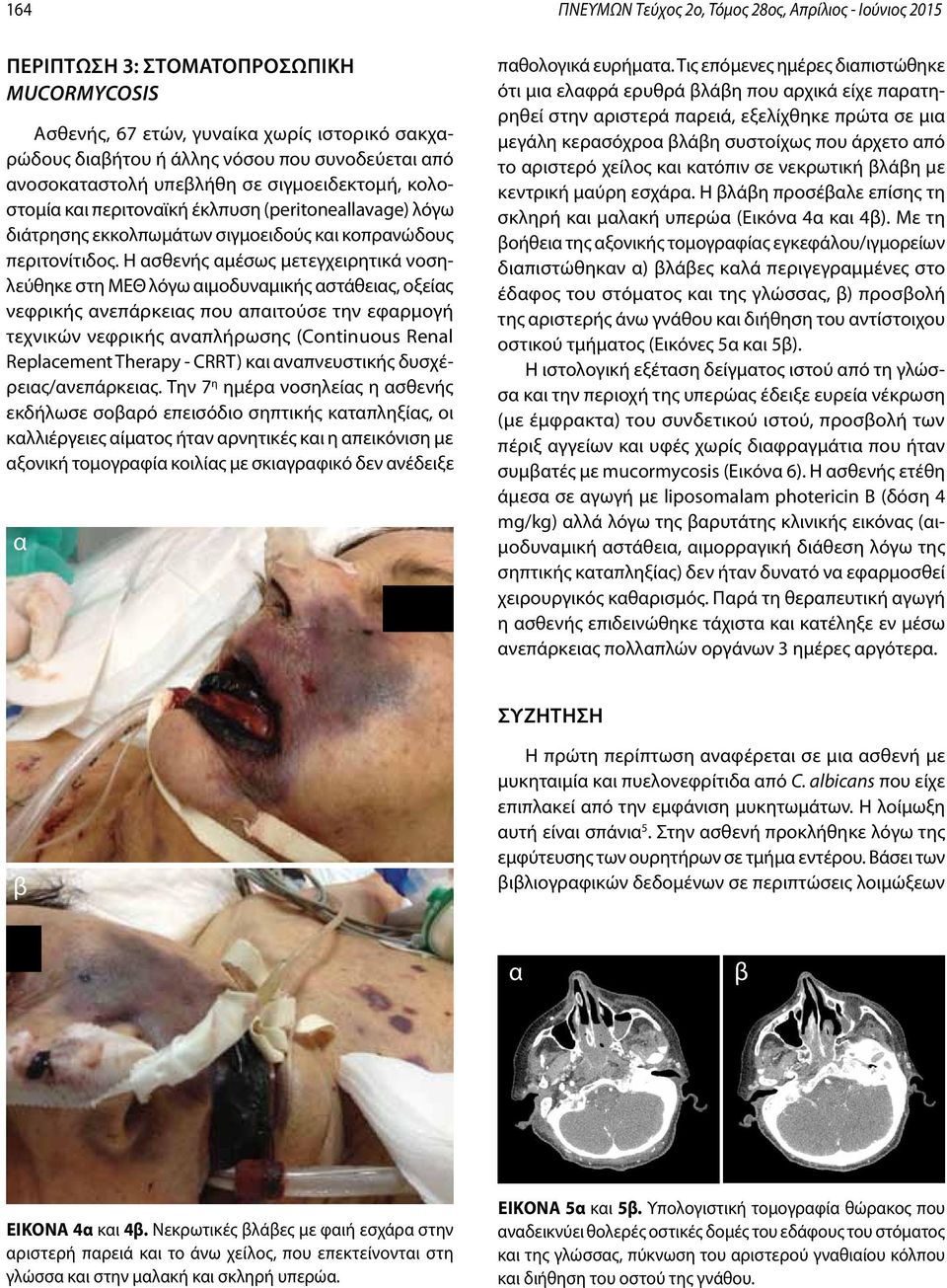 Η ασθενής αμέσως μετεγχειρητικά νοσηλεύθηκε στη ΜΕΘ λόγω αιμοδυναμικής αστάθειας, οξείας νεφρικής ανεπάρκειας που απαιτούσε την εφαρμογή τεχνικών νεφρικής αναπλήρωσης (Continuous Renal Replacement