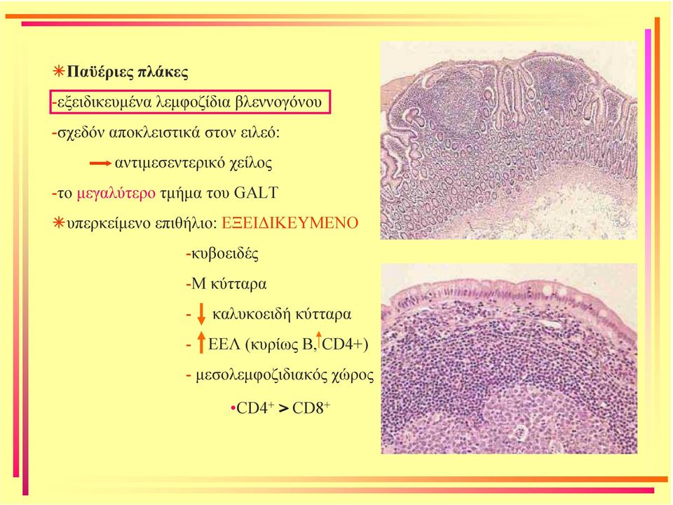 του GALT υπερκείµενο επιθήλιο: ΕΞΕΙ ΙΚΕΥΜΕΝΟ -κυβοειδές -Μ κύτταρα -