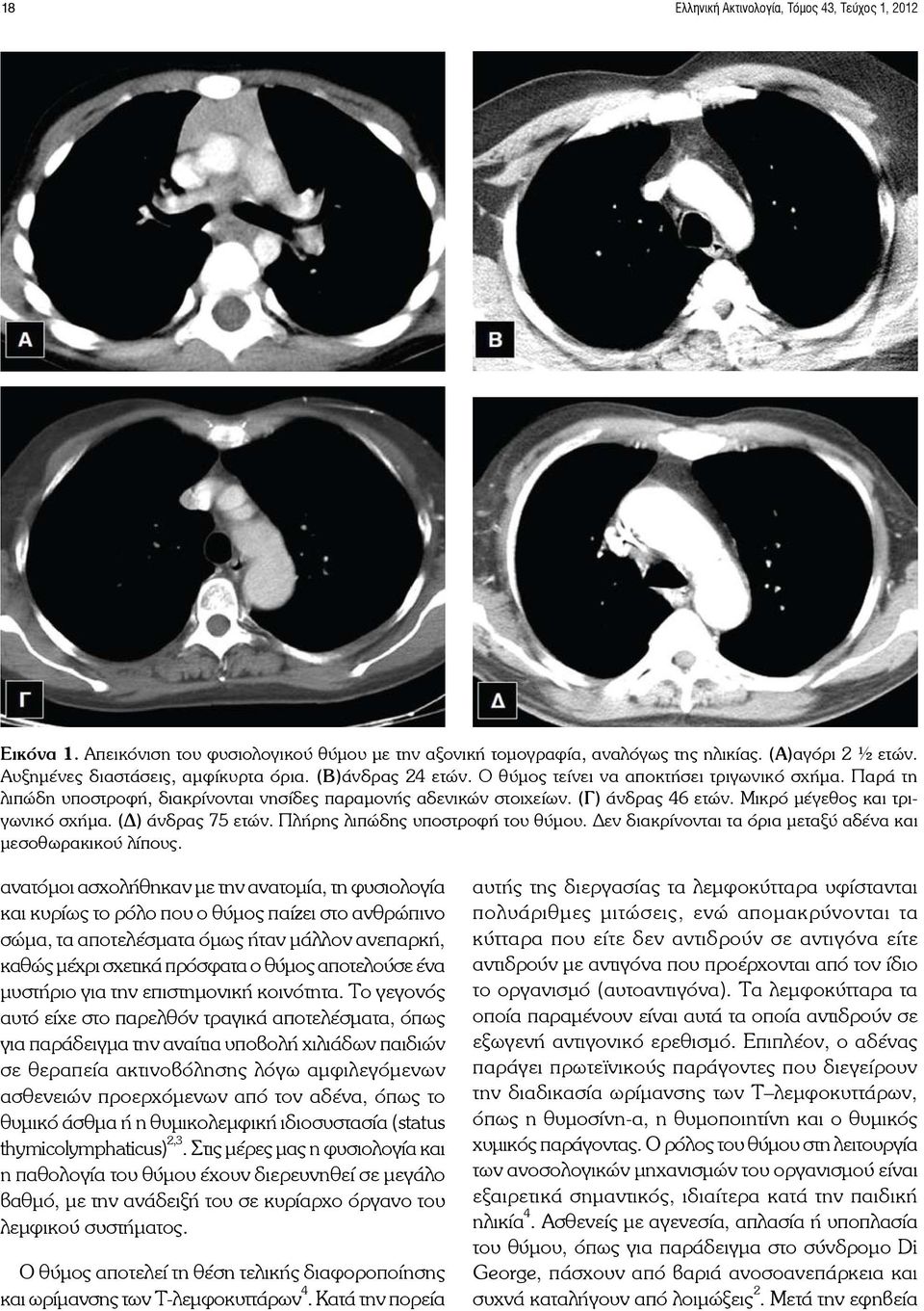 (Δ) άνδρας 75 ετών. Πλήρης λιπώδης υποστροφή του θύμου. Δεν διακρίνονται τα όρια μεταξύ αδένα και μεσοθωρακικού λίπους.