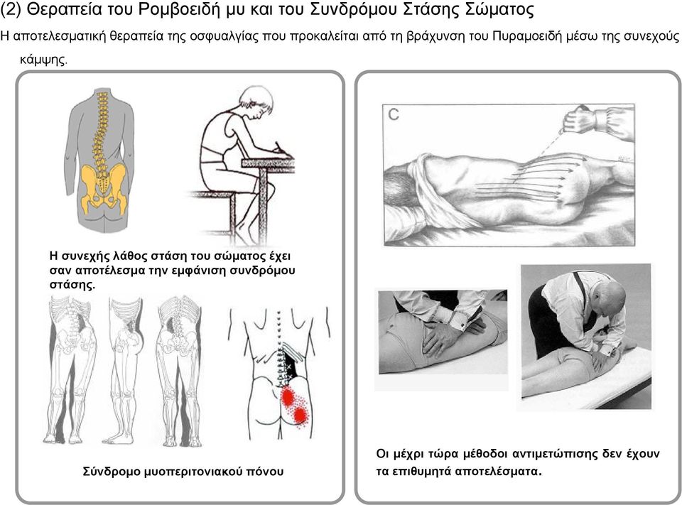 Ησυνεχήςλάθοςστάσητουσώματοςέχει σαν αποτέλεσμα την εμφάνιση συνδρόμου στάσης.