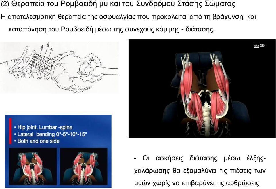 καταπόνηση του Ρομβοειδή μέσω της συνεχούς κάμψης - διάτασης.