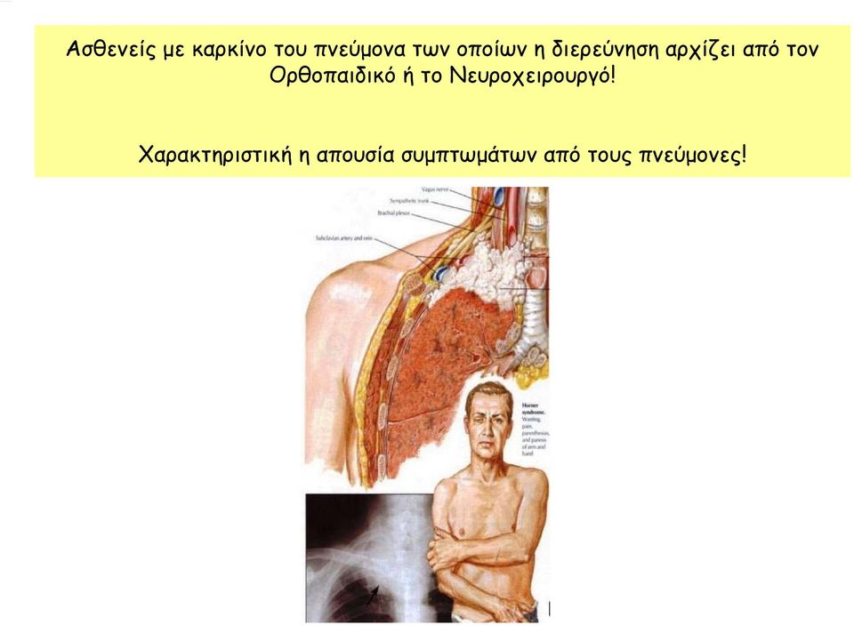 Ορθοπαιδικό ή το Νευροχειρουργό!