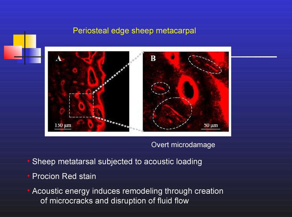 Overt microdamage Acoustic energy induces remodeling