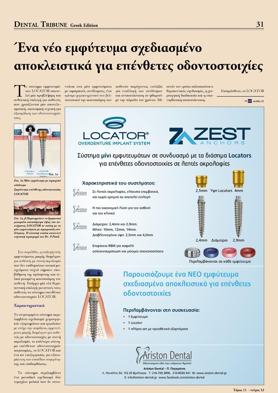 ντάται στα μίνι εμφυτεύματα με σφαιρικούς συνδέσμους, ένα κρίσιμο χαρακτηριστικό που βελτιστοποιεί την ικανοποίηση των ασθενών παρέχοντας ευελιξία για εναλλαγή των συνδέσμων και αντικατάσταση αν