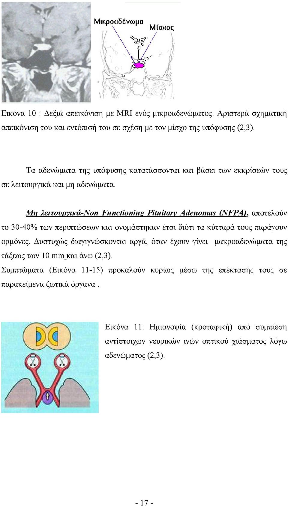 Μη λειτουργικά-non Functioning Pituitary Adenomas (NFPA), αποτελούν το 30-40% των περιπτώσεων και ονομάστηκαν έτσι διότι τα κύτταρά τους παράγουν ορμόνες.