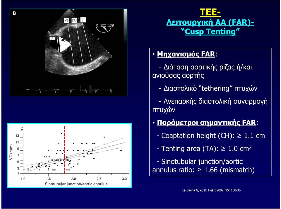 Παράμετροι σημαντικής FAR: - Coaptation height (CH): 1.1 cm -Tenting area (TA): 1.