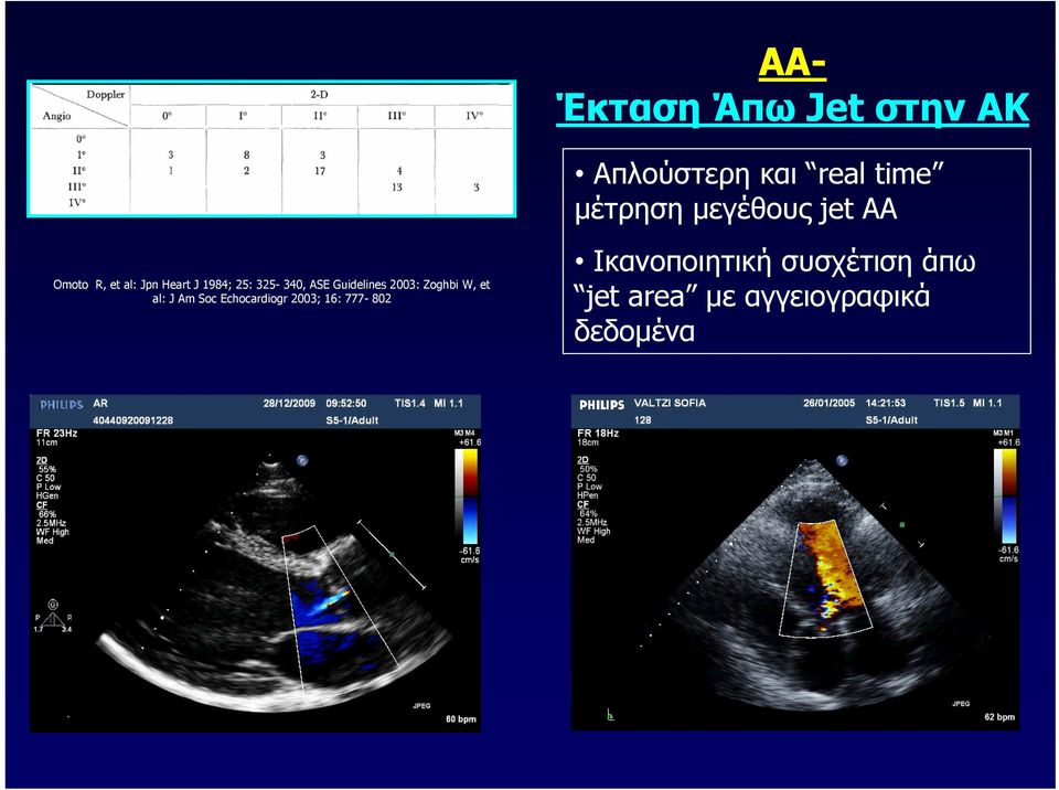 ASE Guidelines 2003: Zoghbi W, et al: J Am Soc Echocardiogr 2003;