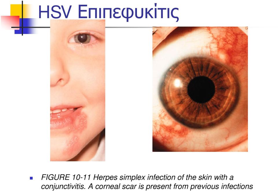 skin with a conjunctivitis.