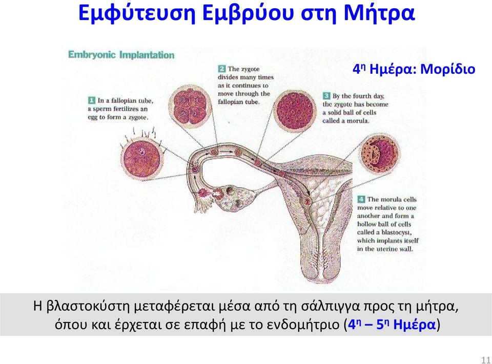 τη σάλπιγγα προς τη μήτρα, όπου και