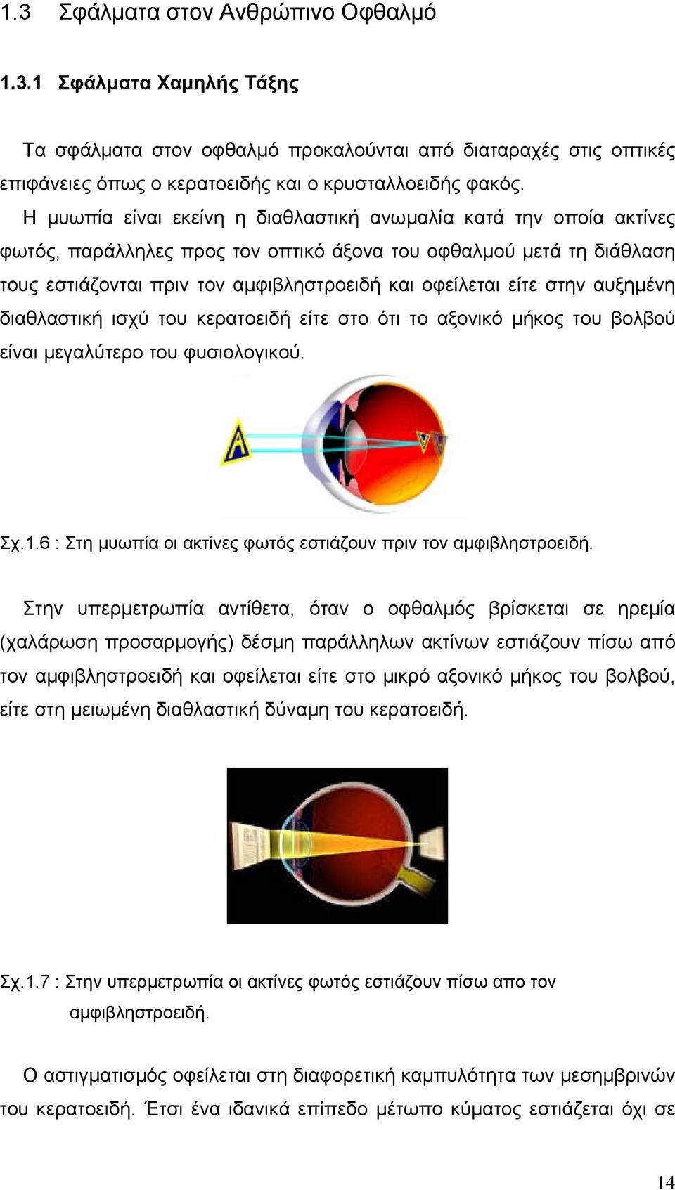 στην αυξημένη διαθλαστική ισχύ του κερατοειδή είτε στο ότι το αξονικό μήκος του βολβού είναι μεγαλύτερο του φυσιολογικού. Σχ.1.6 : Στη μυωπία οι ακτίνες φωτός εστιάζουν πριν τον αμφιβληστροειδή.