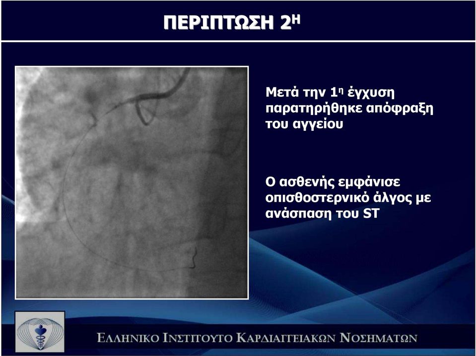 του αγγείου Ο ασθενής εµφάνισε