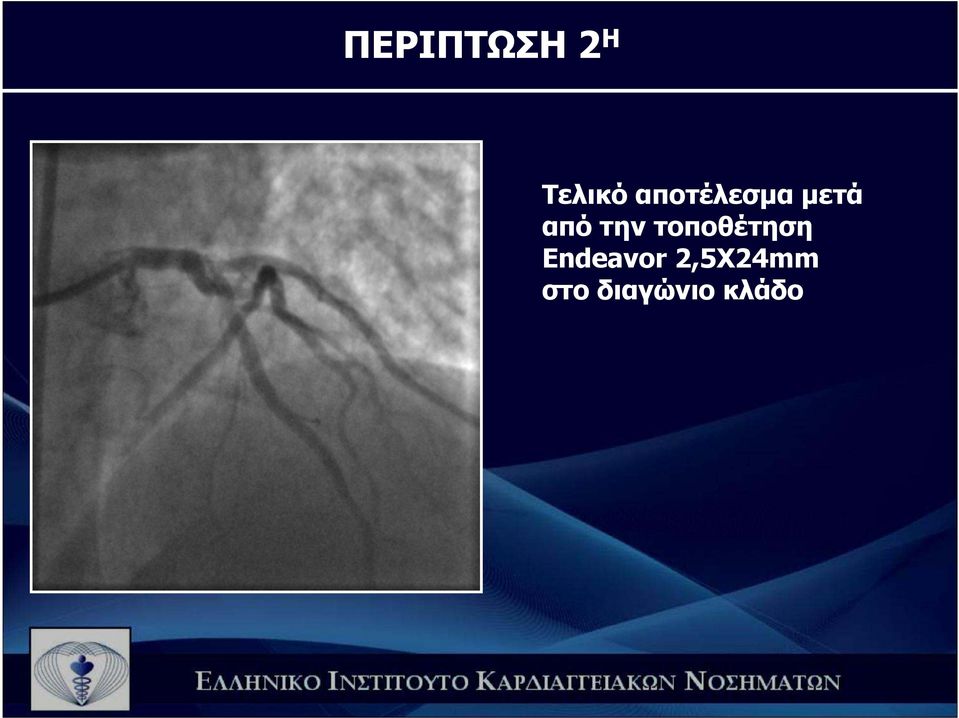 την τοποθέτηση