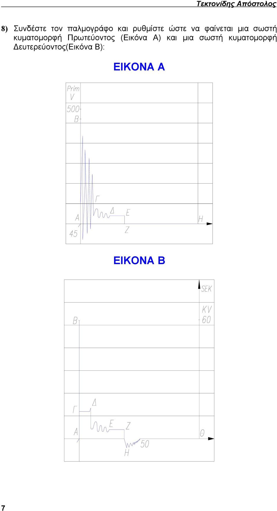 σωστή κυματομορφή Πρωτεύοντος (Εικόνα Α) και μια