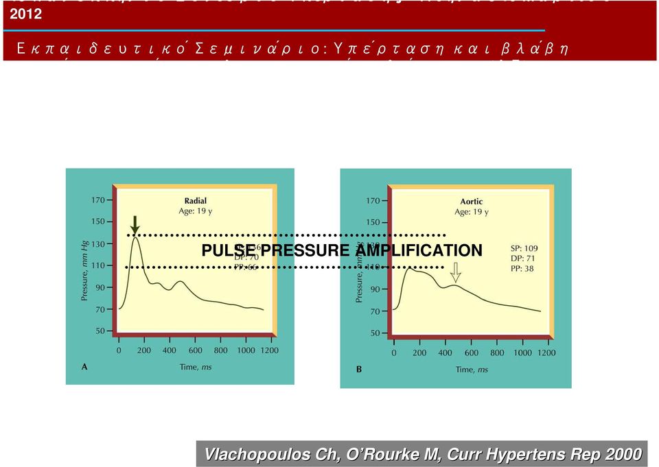 AMPLIFICATION Vlachopoulos Ch, O