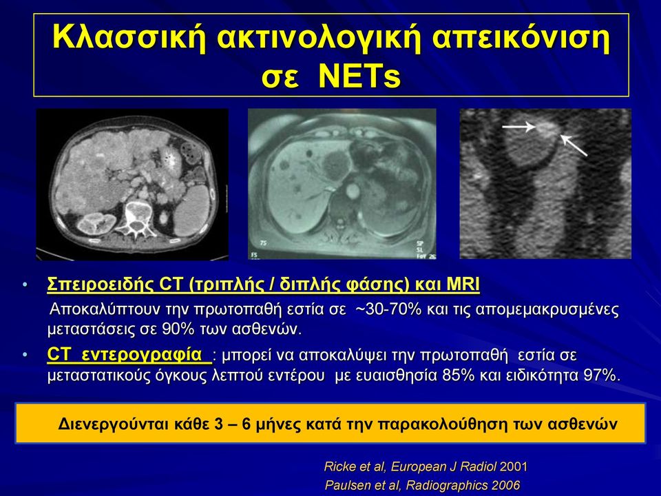 CT ενηεπογπαθία : κπνξεί λα απνθαιύςεη ηελ πξσηνπαζή εζηία ζε κεηαζηαηηθνύο όγθνπο ιεπηνύ εληέξνπ κε επαηζζεζία