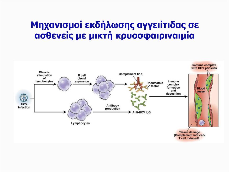 αγγειίτιδας σε