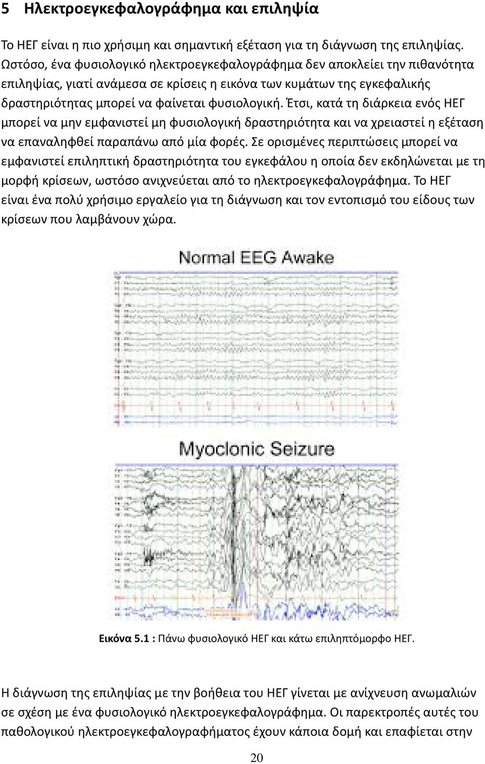 Έτσι, κατά τη διάρκεια ενός ΗΕΓ μπορεί να μην εμφανιστεί μη φυσιολογική δραστηριότητα και να χρειαστεί η εξέταση να επαναληφθεί παραπάνω από μία φορές.